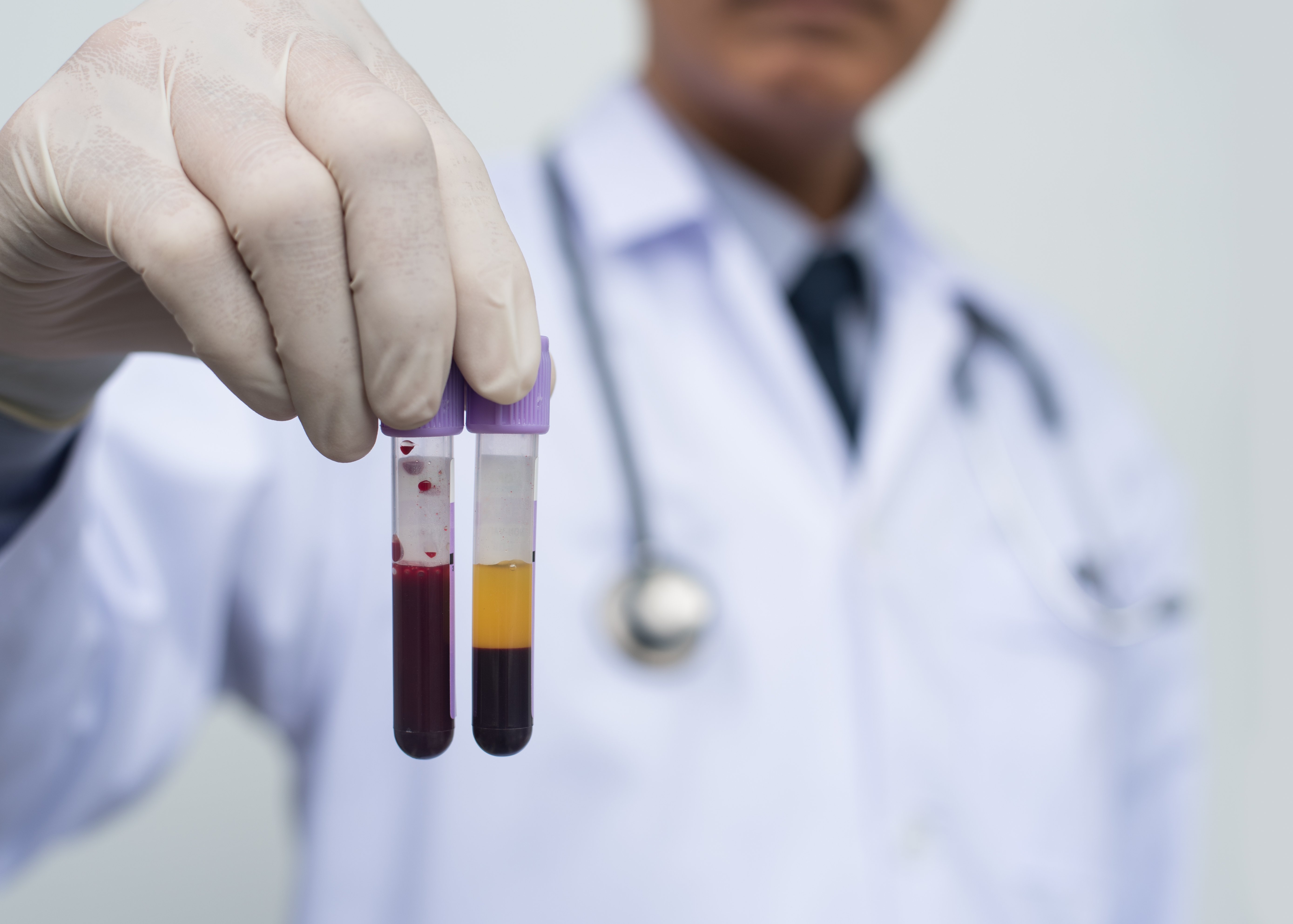 Convalescent Plasma: A Proven but Overlooked Weapon Against New Viral Outbreaks