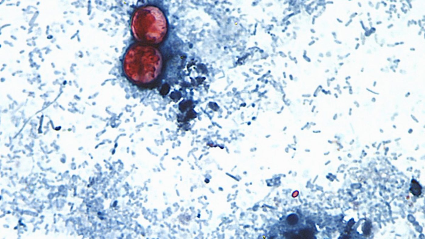 Cyclospora Fallout: 40% of Americans Cut Produce as FDA Trust Erodes