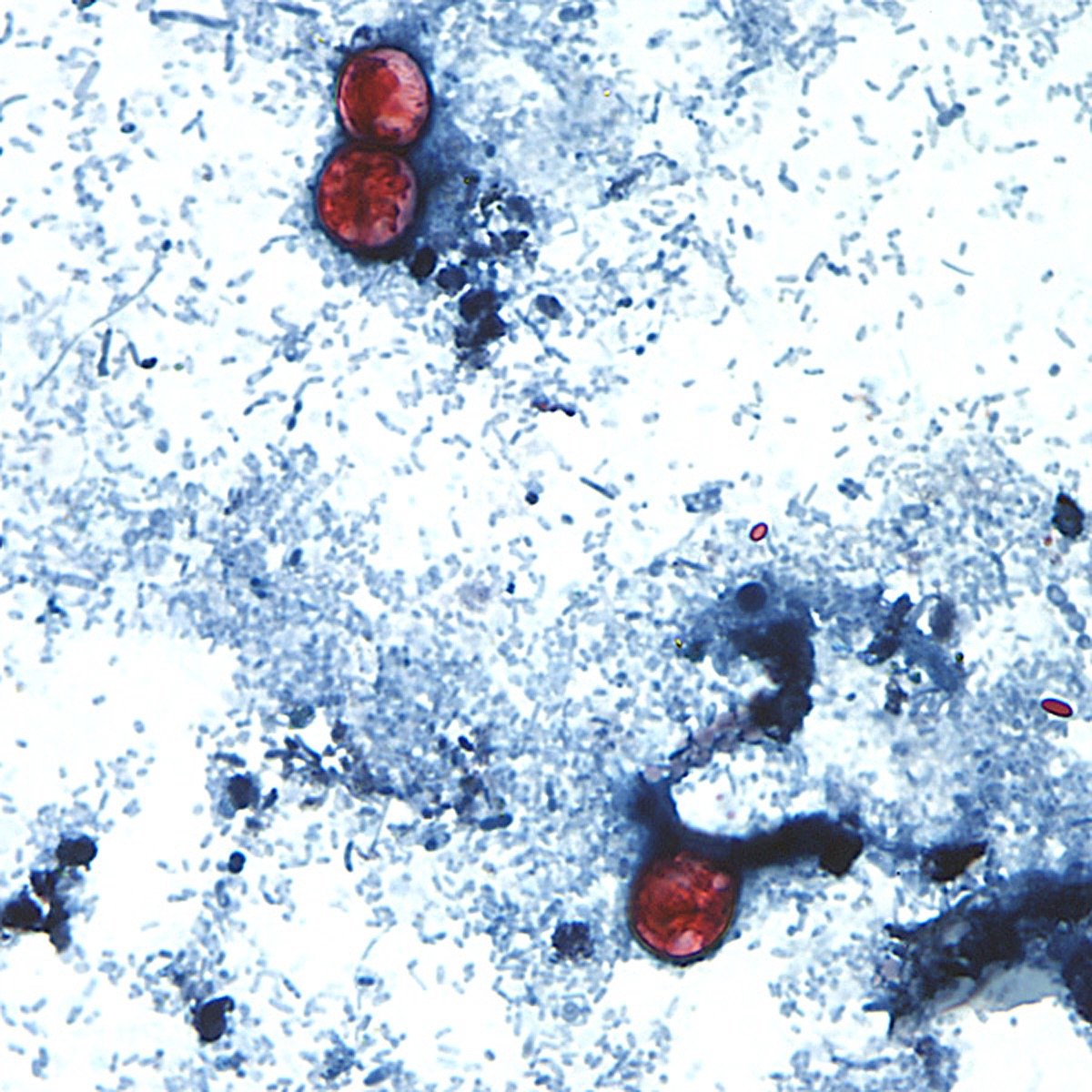 FDA Reverses Lettuce Recall Test Result, Cyclospora Probe Ongoing