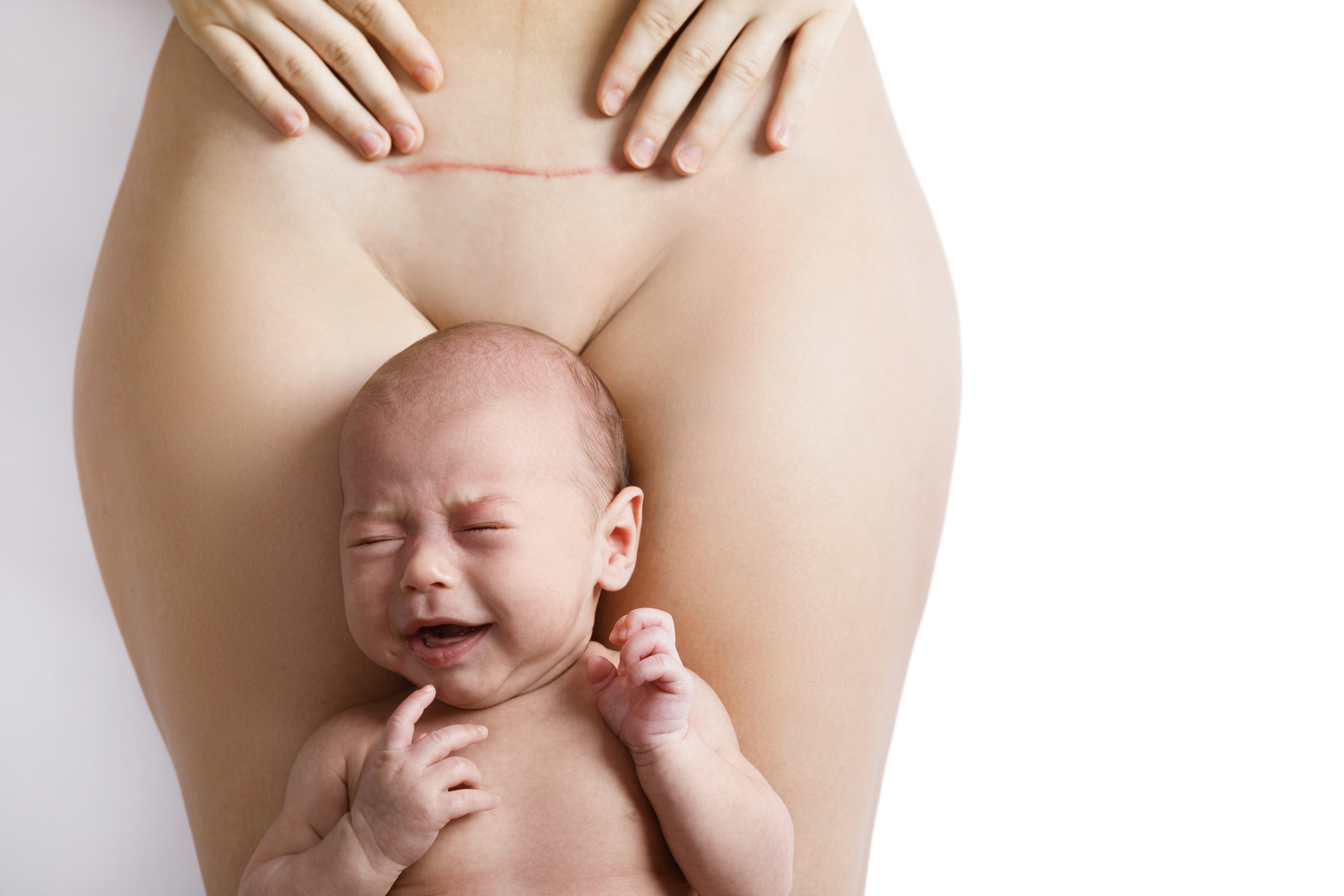 Florida Court Orders Forced C-Section, Threatening Bodily Autonomy
