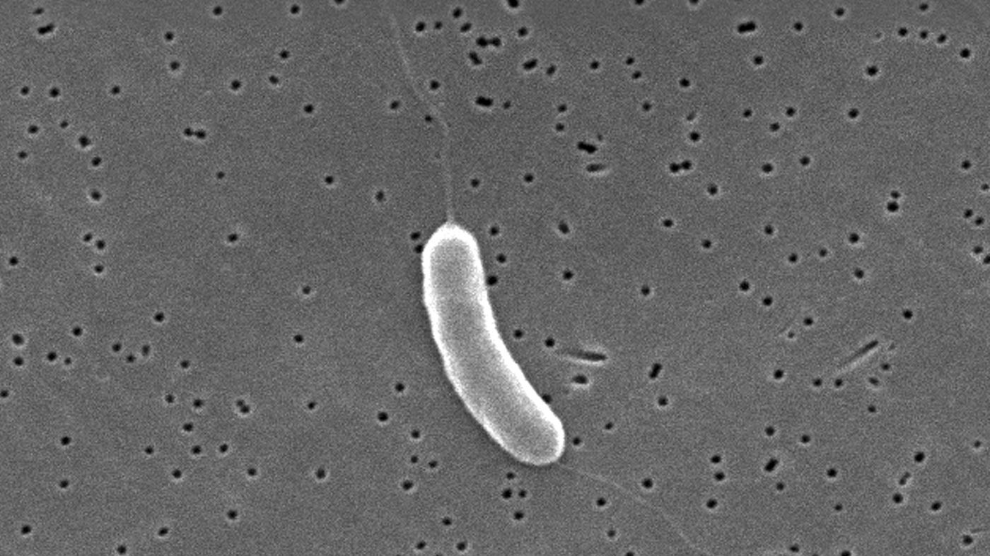 Florida reports third Vibrio vulnificus death as Gulf cases climb