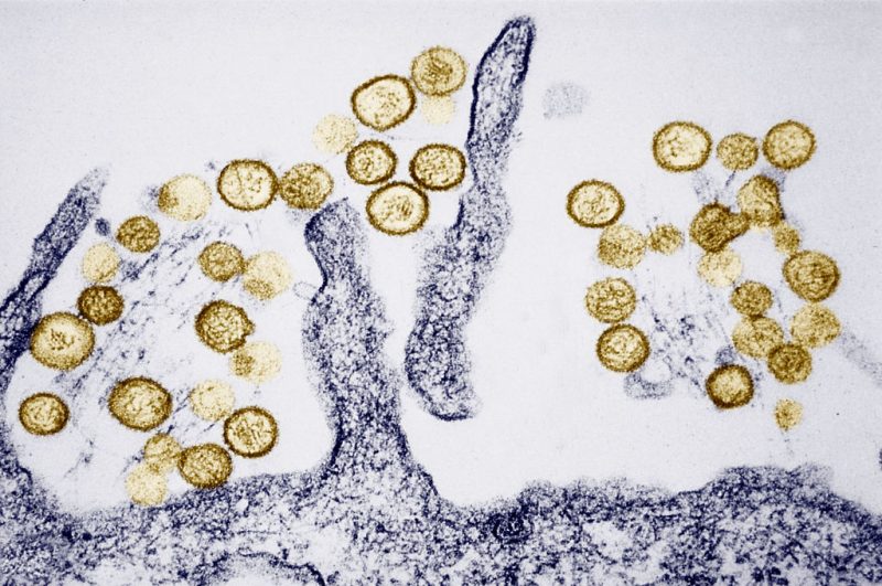 Hantavirus in the US: Where the Rare Rodent-Borne Disease Strikes Most Often