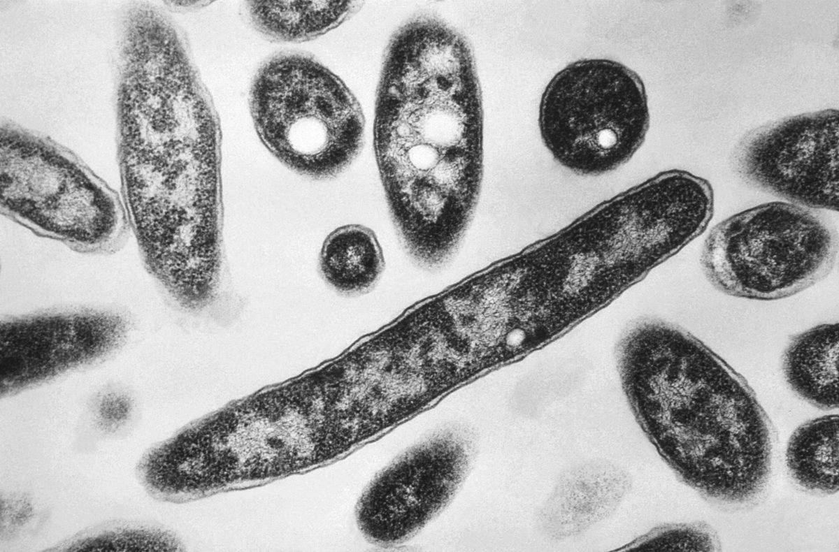 Legionnaires' Outbreak Expands on Manhattan's Upper East Side