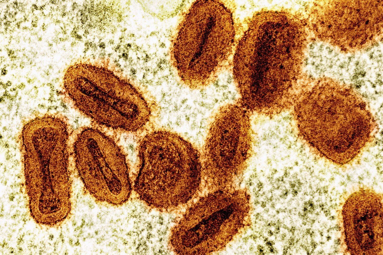 NIH Scientists Charged with Smuggling Mpox Virus Samples into US via Detroit