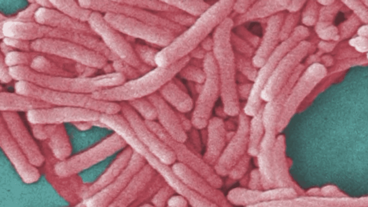 Second Fatality Confirmed in Bronx Legionnaires' Outbreak