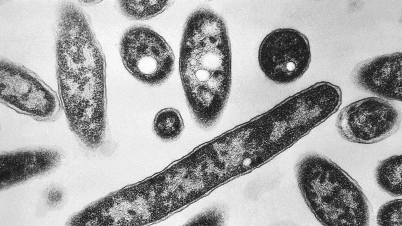 Third Fatality Confirmed as NYC Legionnaires’ Outbreak Reaches 74 Cases