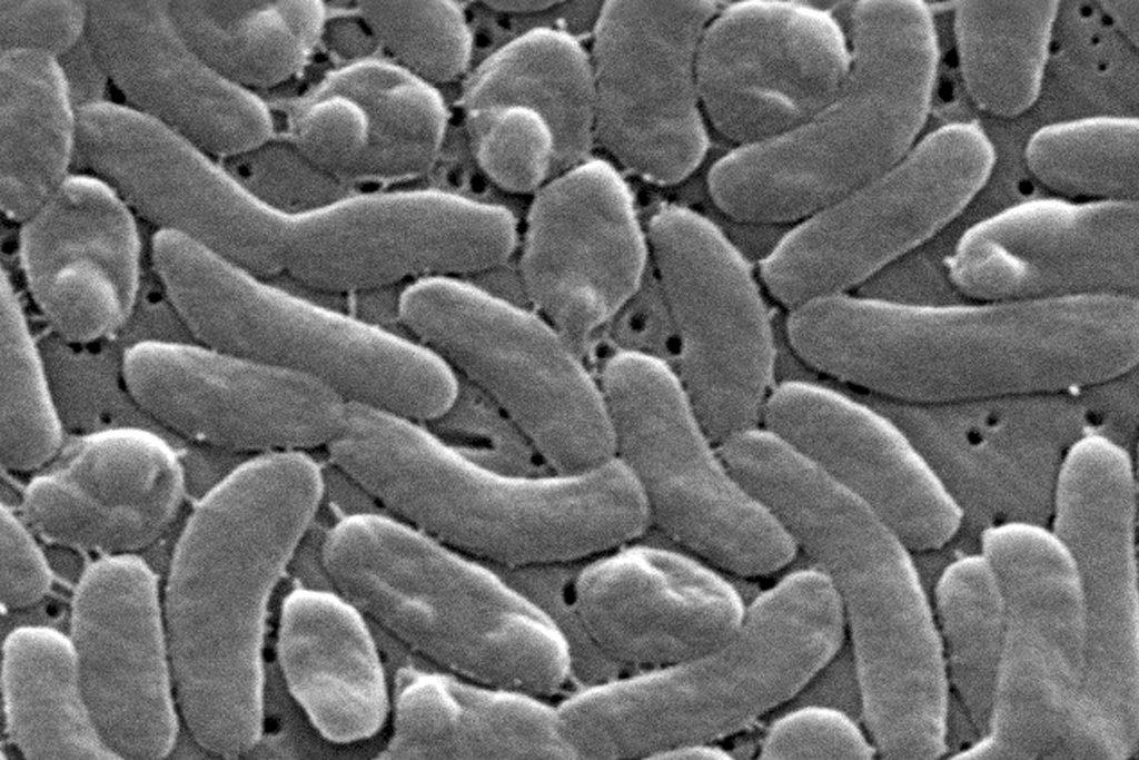 Vibrio Infections Surge as Coastal Waters Warm: What to Know About the 'Flesh-Eating' Bacteria